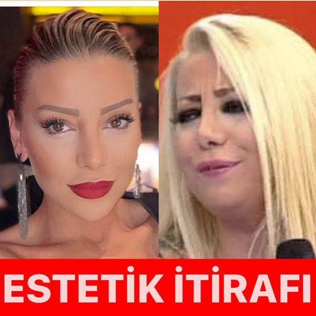 gulsah saracoglu ndan estetik aciklamasi